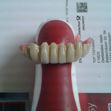 Dentallabor Zahnersatz Bild